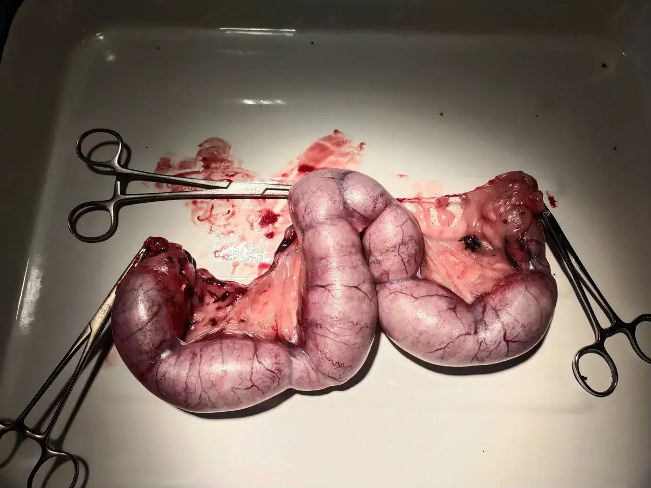 Usunięte narządy rozrodcze suki po zabiegu sterylizacji. Widać naczynia krwionośne i krew, co może sugerować niedawny zabieg, jak np. sterylizacja w trakcie cieczki u psa.